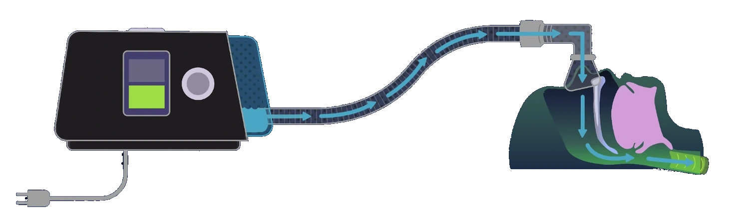 The whole system drawn left to right: the machine with its power cord, a ribbed hose curving across to a mask, and a cross-section of the sleeper’s airway, with cyan arrows showing air traveling the full length.